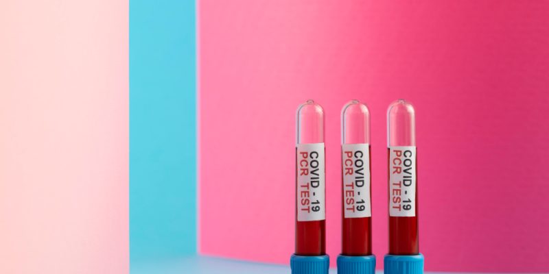 Lip Chap Containers
